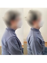 ランドル(rendre)/70代女性　肩こり、腰痛