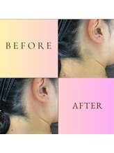 ルナソルビューティーサロン 浜松店(Lunasol)/Wax脱毛だから出来る仕上がり！