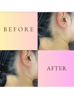 ルナソルビューティーサロン 浜松店(Lunasol)/Wax脱毛だから出来る仕上がり!