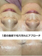 リボーン(Reborn)&nbsp;kinoshita 