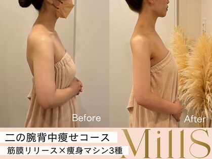 【二の腕|痩身専門店】Esthetic Salon MillS 天神店の写真