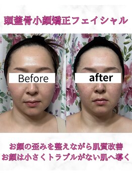 カエラ(Kaela)の写真/【完全個室のプライベート空間】周りを気にせずリラックス♪人には聞かれたくないお身体の悩みや相談も◎