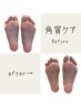 足裏つるつるケア¥4950→¥4400