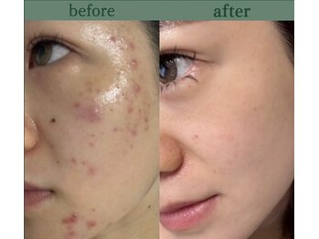 リナート(Rinato)