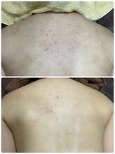 ギャラクシービューティー(galaxy beauty)/シャワーで美背中