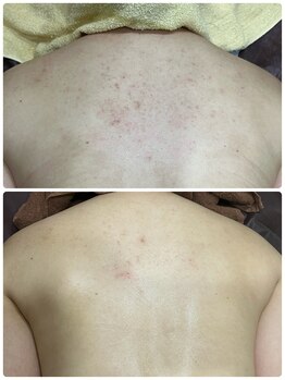 ギャラクシービューティー(galaxy beauty)/シャワーで美背中