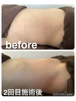 ギンザアール(GINZA R.)/ぽっこりお腹解消♪