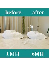 ロータス ビューティー(LOTUS Beauty)/石膏パックで小顔/保湿ケア