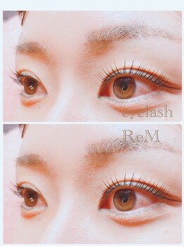 リエム(ReM)/ラッシュリフト