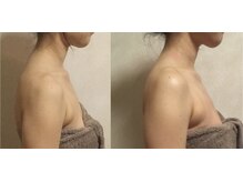 よす香/ビフォーアフター