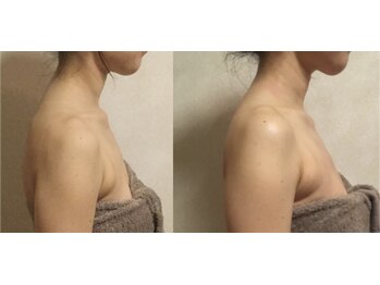 よす香/ビフォーアフター