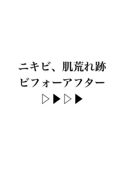 リラ(Lilas)/