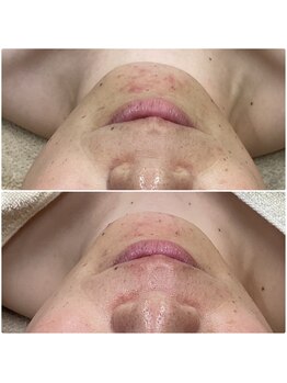 メイス 福井店(MEIS)/お客様before、after