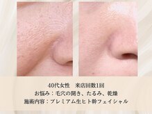 エクストリミティ 国立店(EXTREMITY)/お客様の変化