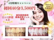 ホワイトニングショップ 鳥栖店