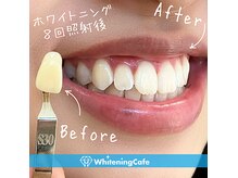 ホワイトニングカフェ 苫小牧店(WhiteningCafe)の雰囲気（ホワイトニングの症例写真はフォトギャラリーをCheck！）