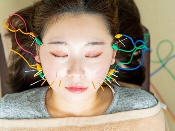 ハリナチュレ 南流山店の写真/美容鍼で小顔を目指す贅沢なご褒美！コラーゲン生成を美容鍼で小顔に整える至福の時♪