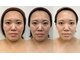 ハーブピーリング 小顔 痩身専門店 salon perleの写真