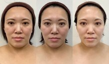 ハーブピーリング 小顔 痩身専門店 salon perle