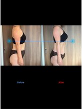 カオン(Kaon)/痩身～バストアップ