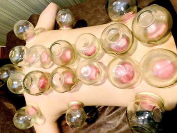 漢方アロマサロン 大森/【院長による吸い玉療法】