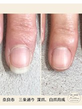 カロッス(Kallos)/ネイルケア