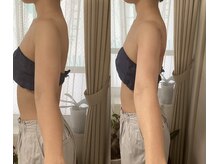 ホワイティアビシェル 浦和(Whitia Vishell)/浦和高周波フォーカス上半身痩せ