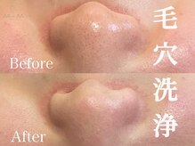テテアテテ(tete a tete)の雰囲気（毛穴の黒ずみ気にならない？？プロにお任せケアで毛穴すっきり☆）