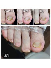 爪切り屋 足楽/