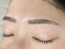 エマ(Emma)/スレッティング(糸脱毛)