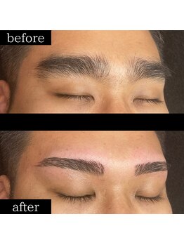 ユー 千葉駅前店(you)/症例写真