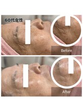 ルシアル(LUCIALL)/