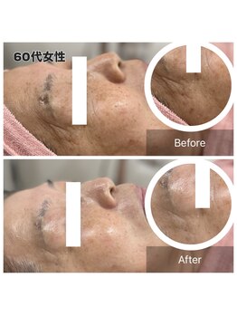 ルシアル(LUCIALL)/