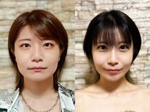 アゴラ/【小顔】豊富な施術実績有り