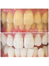 ホワイトニングルーム 川崎店(WhiteningRoom)/ホワイトニング/川崎