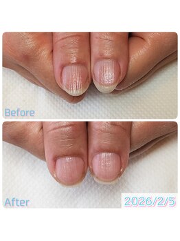 スペシャルハンドケア