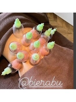 エステティックサロン ビエラブ(bierabu)/【オプション】お腹カッピング