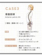 ナチュラル整体院/腰痛/反り腰/姿勢改善