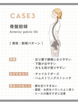 ナチュラル整体院/腰痛/反り腰/姿勢改善