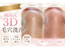 シュエット(Chouette)