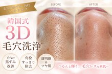 シュエット(Chouette)