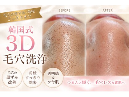 シュエット(Chouette)の写真