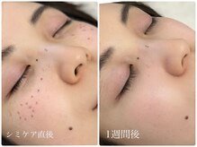 ラウレア(LAULEA)