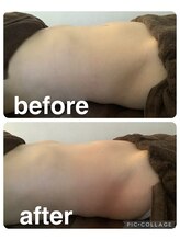 ギンザアール(GINZA R.)/ぽっこりお腹にアプローチ！