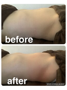 ギンザアール(GINZA R.)/ぽっこりお腹にアプローチ！