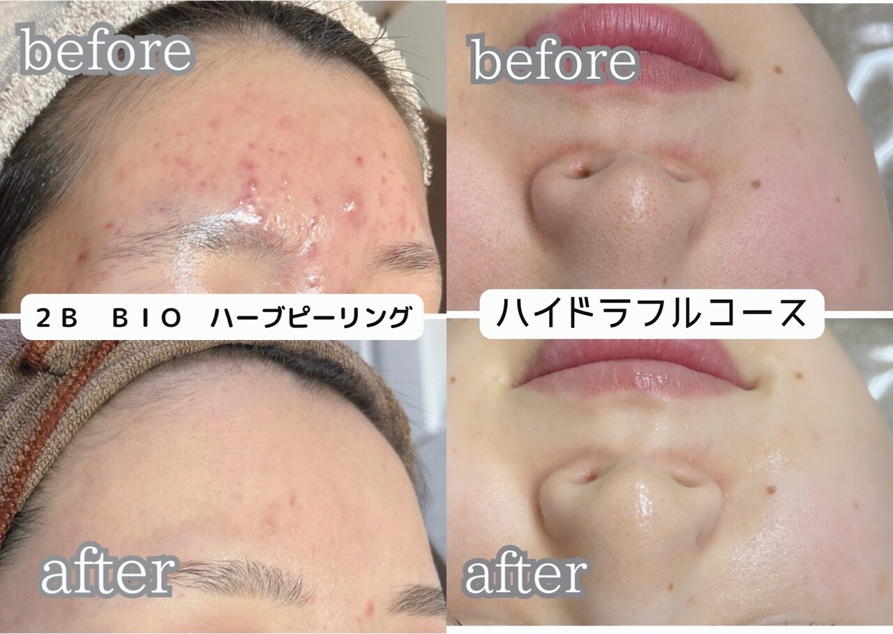 大濠公園駅で光フェイシャルが人気のエステサロン｜ホットペッパー