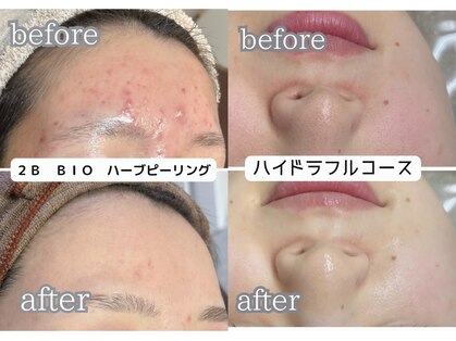 クラリ(Clari)の写真