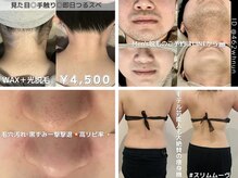 フラン(FRANC)の雰囲気（2回目以降も低価格で通いやすい◎美と癒しのトータルサロン♪）