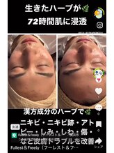 フーレスト アンド フリーリー(Fullest&Freely)/ハーブピーリング