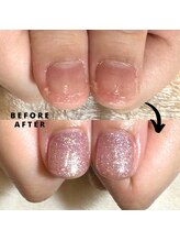 プラスワン(+1)/ハンド深爪矯正